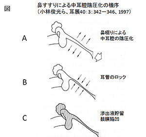 図　鼻すすりによる中耳腔陰圧化の機序（小林俊光ら、耳展40：3；342−346、1997）