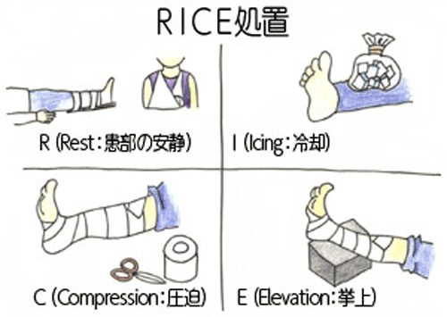 Rice処置