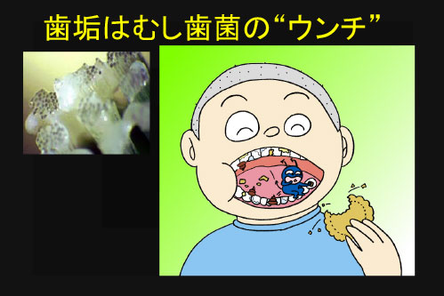 わかりやすい歯科指導 例え話の応用 第６回 歯と口からの健康支援 なぜ なに どうして 学校保健 特集 学校保健ポータルサイト