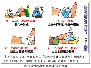 図3：応急処置の基本はRICE処置
